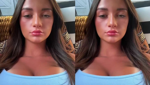 Gianna Thimons - 20250724 #fyp just a little sunburntâ¦ [7530777594543836471]